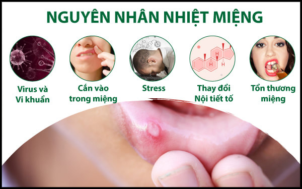 Các nguyên nhân khác gây nhiệt miệng